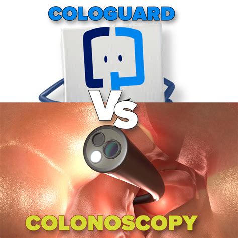 Cologuard vs Colonoscopy: Which test is best? - Atrantil