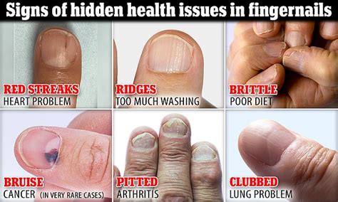 What do your fingernails say about you? Key signs can reveal clues to ...