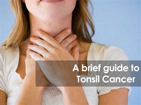 Tonsil Cancer - CancerWalls