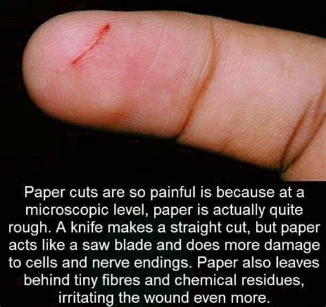 Paper cuts are so painful is because at a microscopic level, paper is actually quite rough. A ...