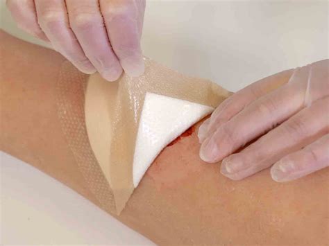 How to change wound dressings | Mölnlycke Advantage