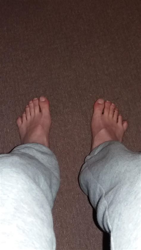 I have six toes on both of my feets : r/mildlyinteresting