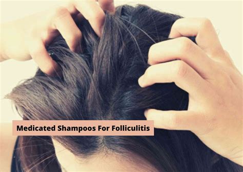 The 4 Best Shampoo For Folliculitis 2022 | For A Clean, Healthy Scalp ...