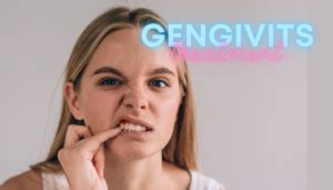 Gingivitis: Effective Home Remedies for Bleeding Gums