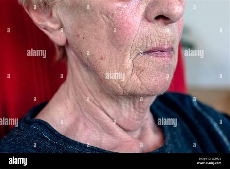close-up of the face and neck of an old woman Stock Photo - Alamy