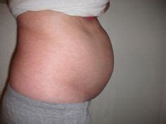 14 Best Severe bloating images | Severe bloating, Candida diet, Plexus products