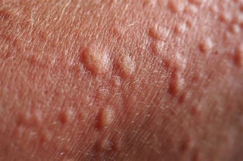 Bumps on Skin: Skin Mysteries Explained | Reader's Digest