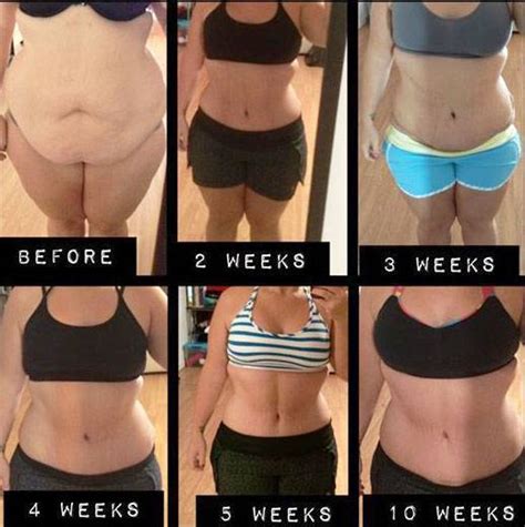 Lipo and tummy tuck recovery before and after photos » Tummy Tuck: Prices, Photos, Reviews, Info ...