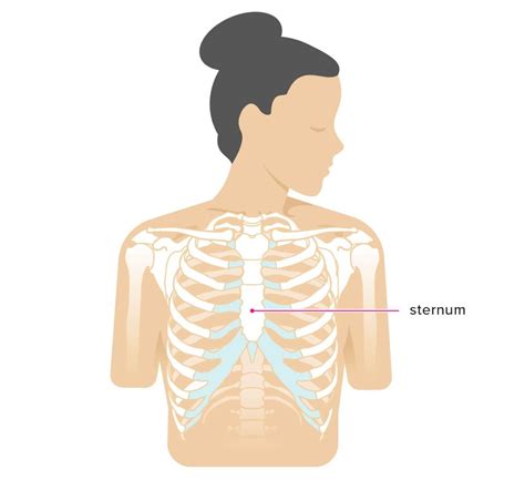 Sternum Popping: Treatment, Pain, Chest Pain, and Symptoms