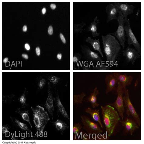 Anti-LAMP1 antibody - Lysosome Marker (ab24170) Protocols