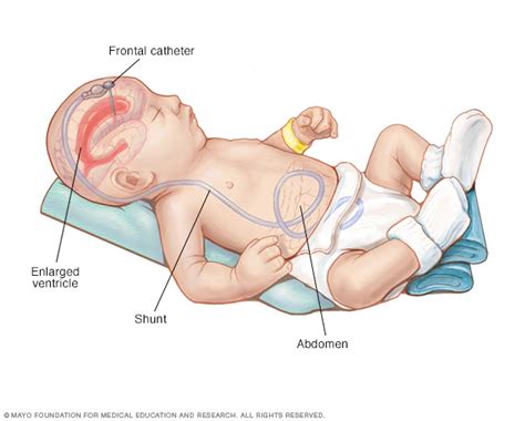 Pin by Chen Hongyan on abraheem in 2020 | Cerebrospinal fluid ...