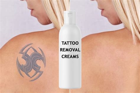 7 Tattoo Removal Creams Worth Investing On!