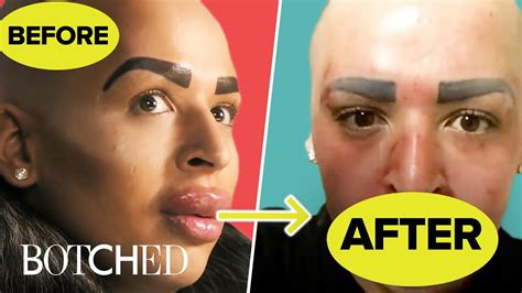 Man With Big Lips On Botched | Lipstutorial.org