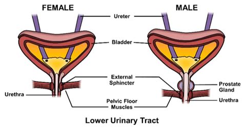 Indication of Catheterization for Intermittent Catheters (IC)