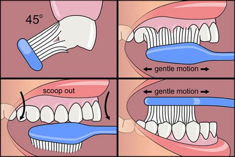 Tooth Brushing Techniques that you should follow - Swikriti's Blog