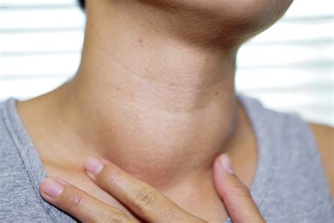 woman-touching-neck-swollen-thyroid-gland