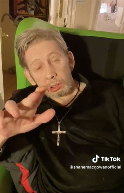 Fans concerned for Shane MacGowan after the legendary singer joins TikTok