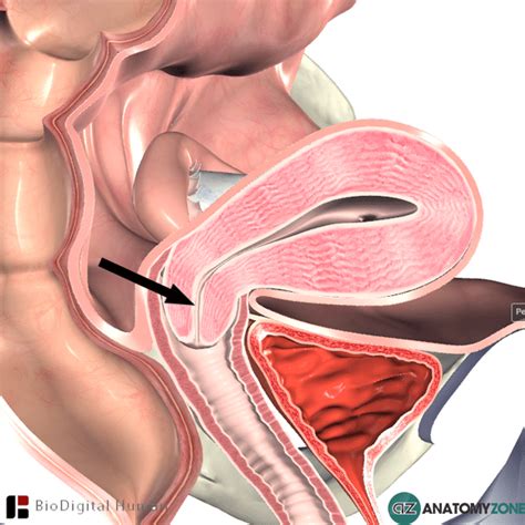 Cervical Canal - AnatomyZone