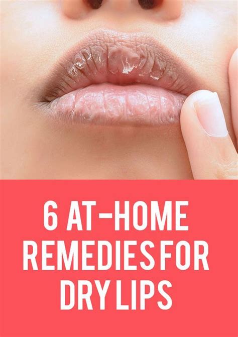 At-Home Remedies For Dry Lips