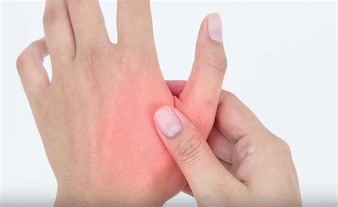 Thumb osteoarthritis, thumb arthritis, thumb pain, arthritis in hand, basal joint, basal joint ...