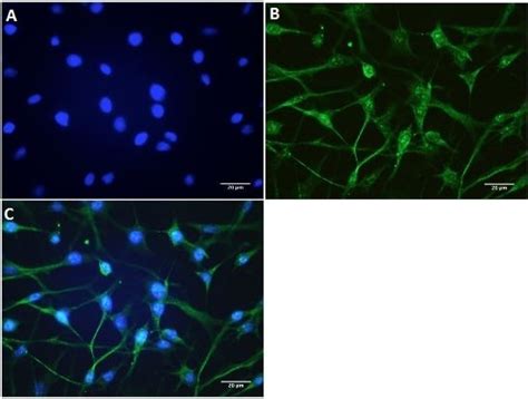 Anti-TRPV1 antibody [BS397] - C-terminal (ab203103) | Abcam