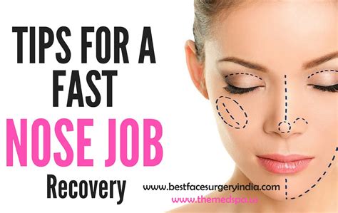 Nose Job – Quick guide to recovery