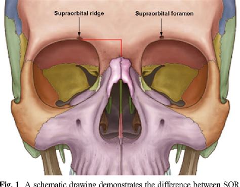 Anatomical variations of supraorbital notch and foramen: a study on human adult Egyptian skulls ...