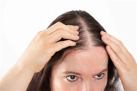 Thinning hair & female hair loss causes, prevention, diagnosis & treatment