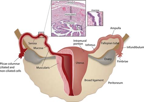 Imaging Evaluation of Fallopian Tubes and Related Disease: A Primer for ...