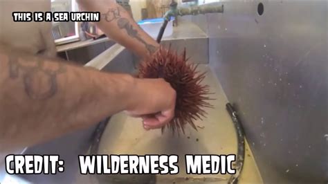 Sea Urchin Spine Removal (Bonus Cyst Burst at End) - YouTube