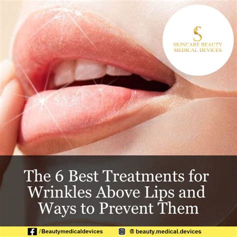 Best Treatments for Wrinkles Above Lips—Plus, Ways to Prevent Them