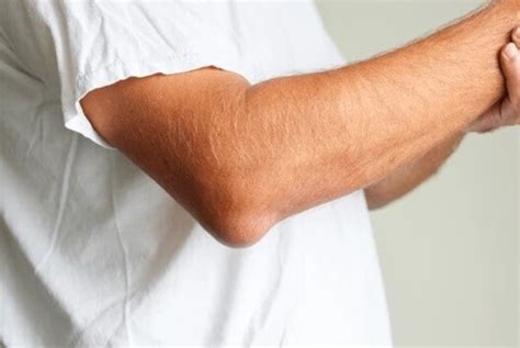 Lump On Elbow: Causes & Treatment For Elbow Bumps & Lumps