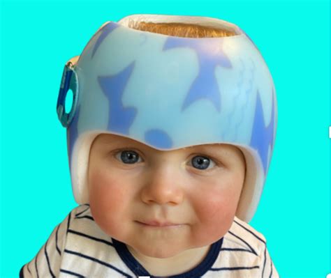 How Should a Helmet Fit? — Baby Bear Cranial Clinic- cranial helmets for babies with flat head