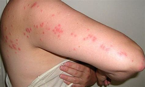 What do Bed Bugs Look Like? This Types and Signs of Bed Bugs