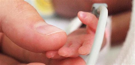 Combined steroid and statin treatment could reduce ‘accelerated ageing’ in preterm babies, study ...