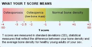 Bone Density (DEXA) - Peninsula Imaging