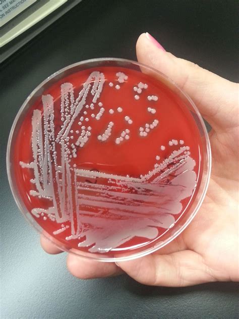 Staphylococcus_aureus_jpeg | MICROBIOLOGY MATTERS