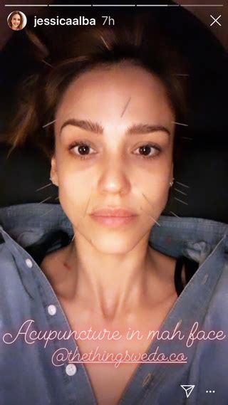 Jessica Alba Posts No-Makeup Selfie On Instagram With Acupuncture