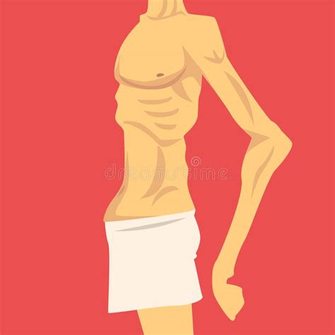 Male Anorexia stock vector. Illustration of unhealthy - 44476797