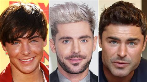 Did Zac Efron Get Plastic Surgery? Everything We Know