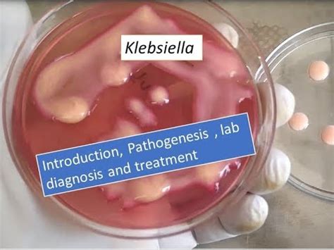 Klebsiella pneumoniae: characteristics, morphology, diseases - science - 2024