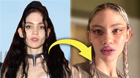 Grimes Admits to Plastic Surgery: Is this the Start of the New ...