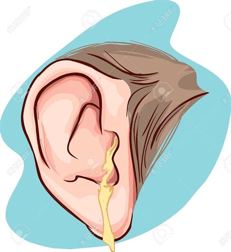 Free download Blue Background Vector Illustration Of A Ear Infection Royalty [1193x1300] for ...