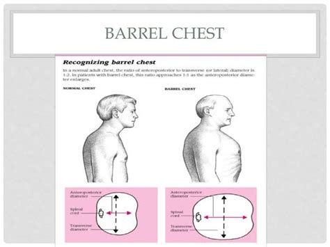 Acute exacerbation of COPD