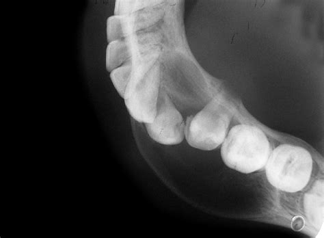 OCCLUSAL RADIOGRAPH 14 | Buyxraysonline