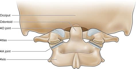 Atlanto-Occipital Joint Injections | Anesthesia Key