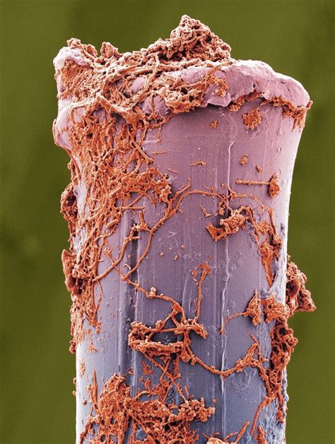 This Is What Tooth Plaque Looks Like Up Close | Microscopic photography, Things under a ...
