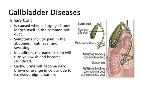 PPT - Structure and Function: The Gallbladder PowerPoint Presentation, free download - ID:2084742