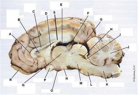 Sheep Brain Dissection labeled 2 Diagram | Quizlet