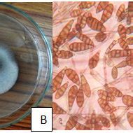 Alternaria alternata:-(A) symptoms of the pathogen on the leaf of... | Download Scientific Diagram